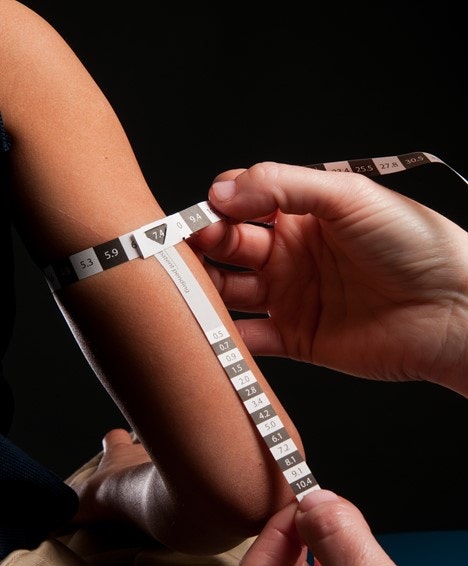 IP License - Mercy Tape: Pediatric Weight Estimator Device
