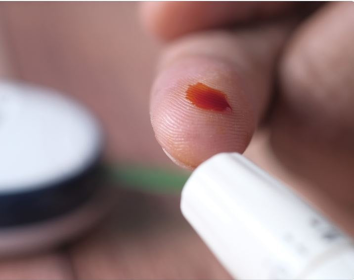 IP License - Medium for Use in HbA1c At-home Sampling