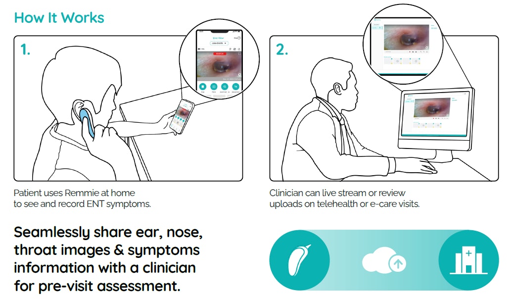 Remmie 4 Portable Otoscope