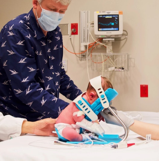 Newborn baby in the SmolTAP positioning cradle and a doctor and medical team assisting.