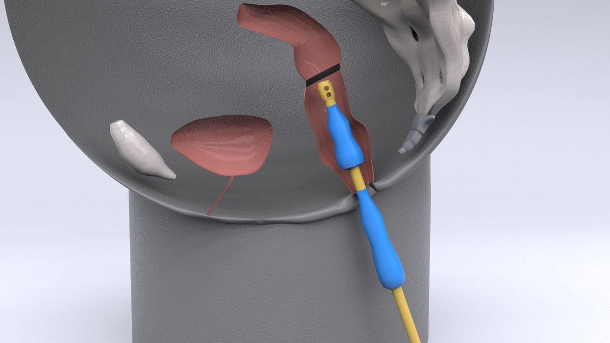 Cephus Catheter: Double Balloon Rectal Catheter